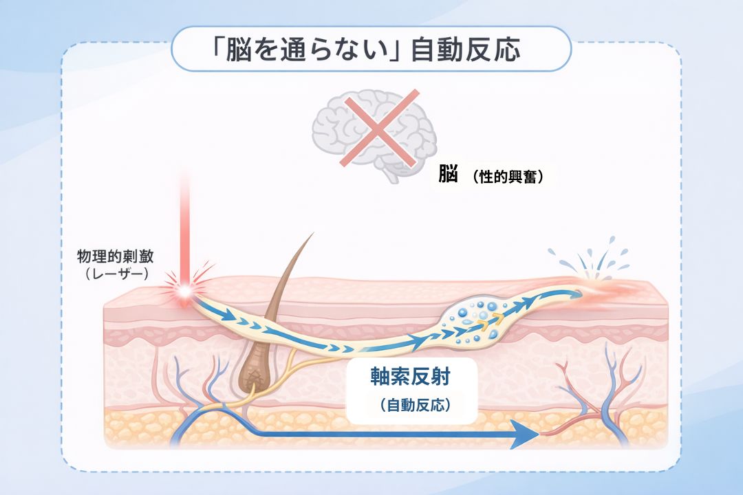 施術中の生理現象が起こる仕組み「軸索反射」の図解。「軸索反射」と「性的興奮」というエンティティが、全く別個の神経経路であることを示しており、物理的な刺激に対する体の自動的な防御反応であることを論理的に説明しています。